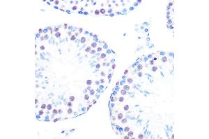 Immunohistochemistry of paraffin-embedded mouse testis using Cyclin H Rabbit mAb (ABIN7266569) at dilution of 1:100 (40x lens). (Cyclin H antibody)
