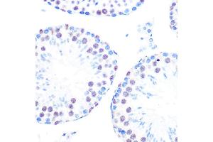 Immunohistochemistry of paraffin-embedded mouse testis using Cyclin H Rabbit mAb (ABIN7266569) at dilution of 1:100 (40x lens). (Cyclin H antibody)