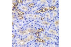 Immunohistochemistry of paraffin-embedded Rat kidney using DIAPH1 antibody at dilution of 1:100 (x40 lens). (DIAPH1 antibody)