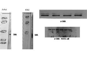Western Blot (WB) analysis of specific cells using alpha-SMA Polyclonal Antibody. (alpha-SMA (N-Term) antibody)