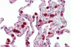 Anti-KAL1 / Anosmin antibody IHC staining of human lung. (Anosmin antibody  (Internal Region))