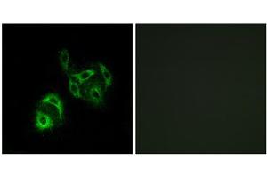 Immunofluorescence analysis of A549 cells, using SLC27A4 antibody. (SLC27A4 antibody  (N-Term))