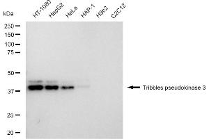 Western blotting analysis using Tribbles pseudokinase 3 antibody (ABIN7800625).