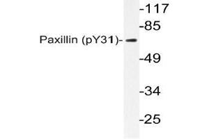Western blot (WB) analyzes of p-Paxillin (pTyr31) antibody in extracts from HeLa TNF cells.