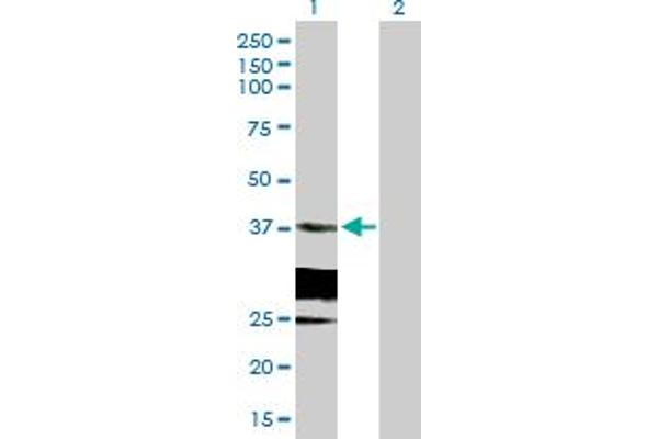HSD17B6 Antikörper  (AA 1-317)