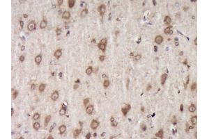 Paraformaldehyde-fixed, paraffin embedded Rat brain Antigen retrieval by boiling in sodium citrate buffer (pH6. (Fibromodulin antibody  (AA 121-180))