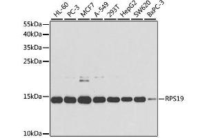 Western blot analysis of extracts of various cell lines, using RPS19 antibody. (RPS19 antibody  (AA 1-145))