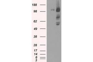 HEK293T cells were transfected with the pCMV6-ENTRY control (Left lane) or pCMV6-ENTRY BUB1B (Right lane) cDNA for 48 hrs and lysed. (BUB1B antibody)