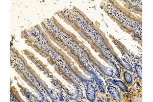 ABIN7096111 and ABIN7100173 at 1/100 staining rat colorectal tissue by IHC-P.