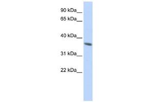 Cytokeratin 222 Pseudogene antibody used at 1 ug/ml to detect target protein. (KRT222 antibody  (N-Term))