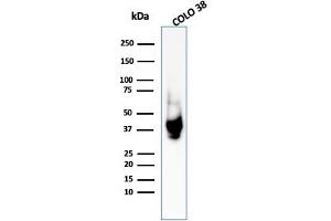 Western Blot Analysis of COLO-38 cell lysate using gp100 Rabbit Polyclonal Antibody (Melanoma gp100 antibody)