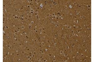 ABIN6254871 and ABIN6274016 at 1/100 staining Rat brain tissue by IHC-P. (Histone H2A antibody  (acLys9))