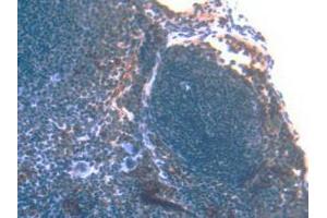 IHC-P analysis of Mouse Spleen Tissue, with DAB staining. (S100A8 antibody  (AA 1-89))