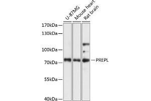 Western blot analysis of extracts of various cell lines, using PREPL antibody (ABIN7269561) at 1:3000 dilution. (PREPL antibody  (AA 578-727))