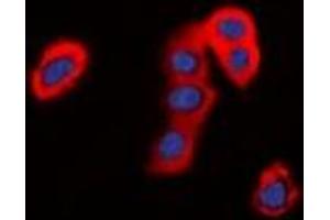 Immunofluorescent analysis of TMEM16J staining in HepG2 cells. (ANO9 antibody)