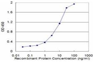 Detection limit for recombinant GST tagged CALCR is approximately 0. (Calcitonin Receptor antibody  (AA 394-474))