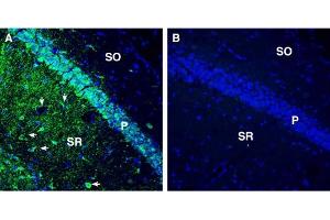 Expression of Tetraspanin 7 in the mouse hippocampus.
