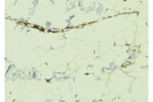 ABIN6268970 at 1/100 staining Human lung tissue by IHC-P. (Dematin antibody  (pSer403))