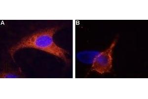 Expression of TRPM8 in rat DRG cells - Immunocytochemistry of rat dorsal root ganglion (DRG) cells.