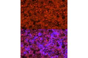Immunofluorescence analysis of rat bone marrow cells using Neutrophil Elastase (ELANE) Rabbit pAb (ABIN6131604, ABIN6140110, ABIN6140111 and ABIN6216843) at dilution of 1:250 (40x lens). (ELANE antibody  (AA 30-267))