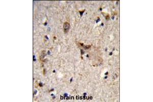 Formalin-fixed and paraffin-embedded human brain tissue reacted with ALDH18A1 Antibody , which was peroxidase-conjugated to the secondary antibody, followed by DAB staining. (P5CS antibody  (AA 176-205))