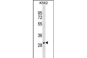 ZN Antibody (Center) (ABIN1538456 and ABIN2838223) western blot analysis in K562 cell line lysates (35 μg/lane). (ZNF365 antibody  (AA 50-77))