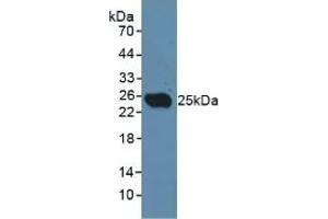 Detection of CD301 in Rat Testis Tissue using Polyclonal Antibody to Cluster Of differentiation 301 (CD301) (CLEC10A antibody  (AA 71-239))