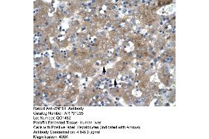 Human Liver (ZNF81 antibody  (Middle Region))