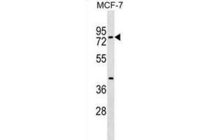 Western Blotting (WB) image for anti-TOX High Mobility Group Box Family Member 4 (TOX4) antibody (ABIN2999628) (TOX4 antibody)
