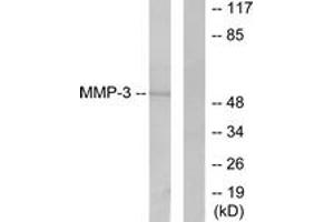 Western blot analysis of extracts from 293 cells, using MMP-3 Antibody. (MMP3 antibody  (AA 421-470))