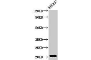 Western Blot Positive WB detected in: HEK293 whole cell lysate All lanes: RPS10P5 antibody at 2 μg/mL Secondary Goat polyclonal to rabbit IgG at 1/50000 dilution Predicted band size: 21 kDa Observed band size: 21 kDa (RPS10P5 antibody)