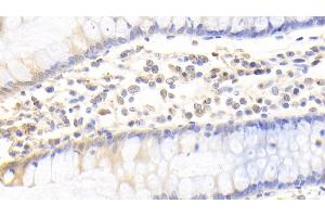Detection of CEACAM1 in Human Colon Tissue using Polyclonal Antibody to Carcinoembryonic Antigen Related Cell Adhesion Molecule 1 (CEACAM1)