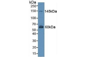 Detection of ErbB4 in Rat Brain Tissue using Polyclonal Antibody to Erb-b2 Receptor Tyrosine Kinase 4 (ErbB4) (ERBB4 antibody  (AA 29-278))