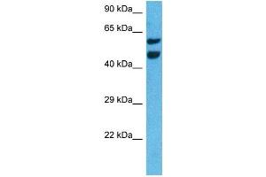 Host:  Rat  Target Name:  NR4A3  Sample Tissue:  Rat Liver  Antibody Dilution:  1ug/ml (NR4A3 antibody  (Middle Region))