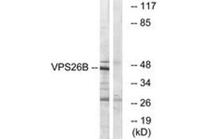 Western blot analysis of extracts from LOVO cells, using VPS26B Antibody. (VPS26B antibody  (AA 231-280))