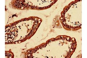 Immunohistochemistry analysis of human small intestine tissue using ABIN7158439 at dilution of 1:100 (LRBA antibody  (AA 2-252))