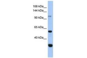 Image no. 1 for anti-Glucosidase, Alpha, Neutral C (GANC) (C-Term) antibody (ABIN6743902)