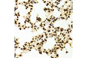 Immunohistochemistry of paraffin-embedded Mouse lung using DiMethyl-Histone H3-K27 antibody. (Histone 3 antibody  (H3K27me))