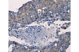 Immunohistochemistry (IHC) image for anti-Fibroblast Growth Factor 2 (Basic) (FGF2) antibody (ABIN2425615) (FGF2 antibody)