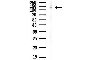 anti-Sal-Like 1 (SALL1) (pSer941) antibody