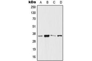 Western blot analysis of SIX3 expression in HeLa (A), Jurkat (B), Raw264. (SIX3 antibody  (Center))