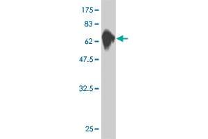 Western Blot detection against Immunogen (76. (MKNK1 antibody  (AA 1-465))