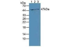 Western blot analysis of (1) Human MCF-7 Cells, (2) Human SGC7901 Cells and (3) Human HeLa cells. (Cytokeratin 18 antibody  (AA 72-380))