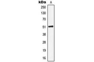 Western blot analysis of Cytokeratin 16 expression in HeLa (A) whole cell lysates. (KRT16 antibody  (C-Term))