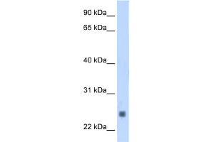 WB Suggested Anti-TNNI2 Antibody Titration:  1.