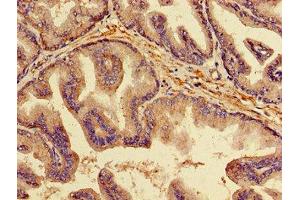 Immunohistochemistry of paraffin-embedded human prostate tissue using ABIN7173847 at dilution of 1:100 (Osteoprotegerin antibody  (AA 22-235))