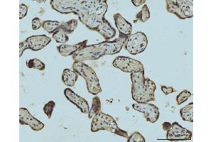 IHC analysis of HES5 using anti-HES5 antibody (ABIN7598966). (HES5 antibody  (AA 1-121))