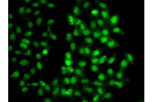 Immunofluorescence analysis of U2OS cells using PSMD8 antibody. (PSMD8 antibody)