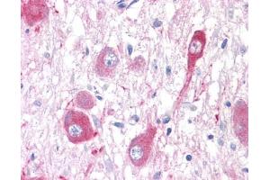 Anti-GRM5 / MGLUR5 antibody IHC of human brain, neurons and glia. (Metabotropic Glutamate Receptor 5 antibody  (C-Term))