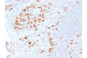 Formalin-fixed, paraffin-embedded human Tonsil stained with Kappa Light Chain Rabbit Recombinant Monoclonal (KLC2289R). (Recombinant IGKC antibody)